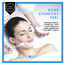 CHEMICAL PEEL EXFOLIATION