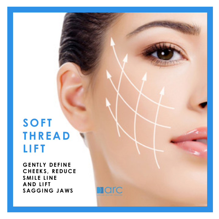 THREADLIFT - SOFT (20 - 30 MINI THREADS)