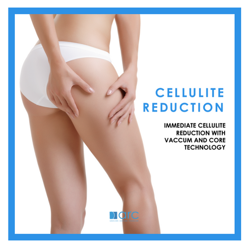 CELLULITE REDUCTION