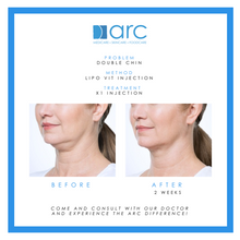 LIPO VIT - FACE INJECTABLE